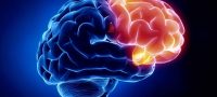 Neurology (1)